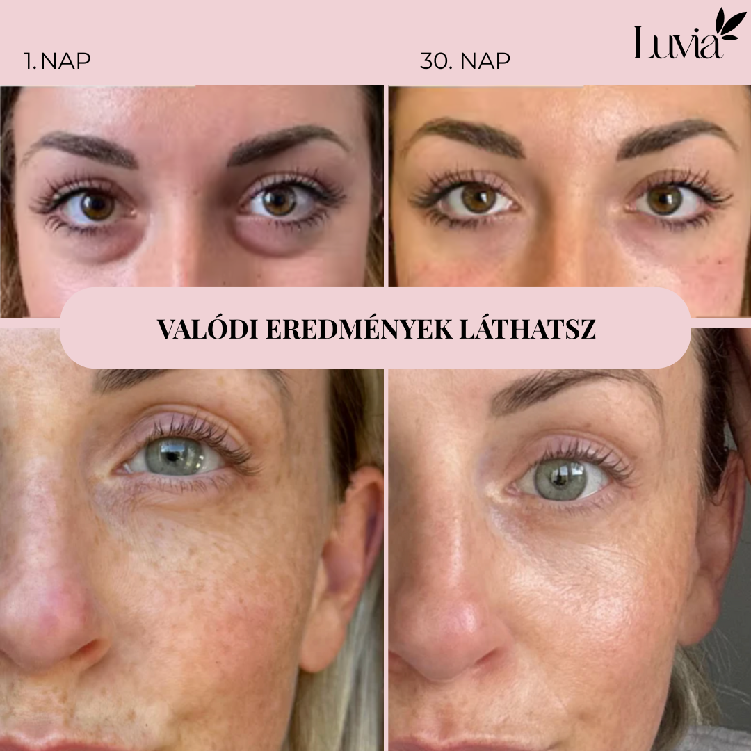 LuviaLift 2.0 - Fényterápia készülék